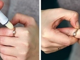 Как снять кольцо с пальца если палец опух фото