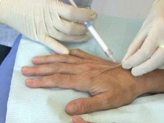Инъекции для омоложения кожи рук