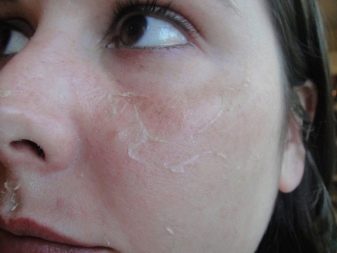 Чистая кожа лица ацетилсалициловая
