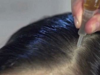 Сыворотка для роста волос alerana противопоказания
