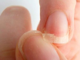 Анатомия и физиология кожи рук и ногтей