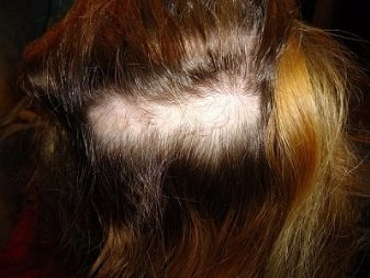 В чем причина выпадения нарощенных волос
