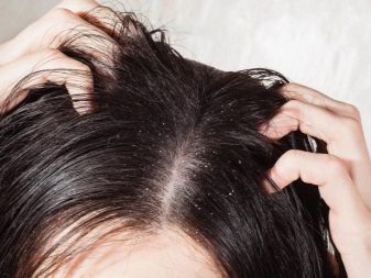 Уход за волосами после химической завивки: советы для красоты и здоровья локонов