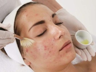 Восстанавливаем кожу на лице