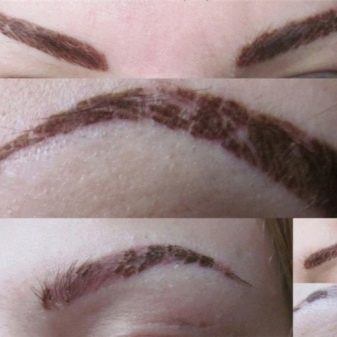 Как заживает перманентный макияж бровей после коррекции thumbnail