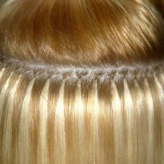 Наращивание волос болит кожа головы