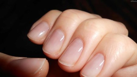 Как восстановить ногти после наращивания?
