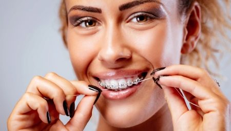Как чистить и ухаживать за зубами с брекетами?