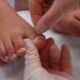 Ногти на ногах растут вверх: причины и методы лечения