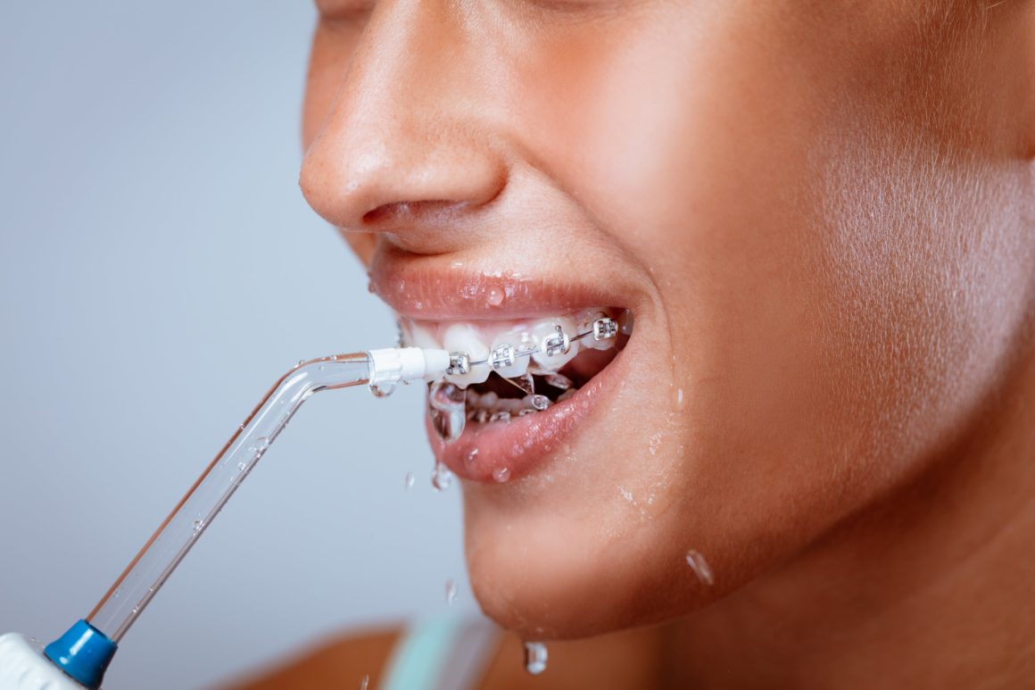 как правильно пользоваться ирригатором полости рта