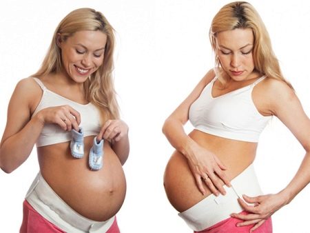 Можно ли носить корсет для позвоночника при беременности
