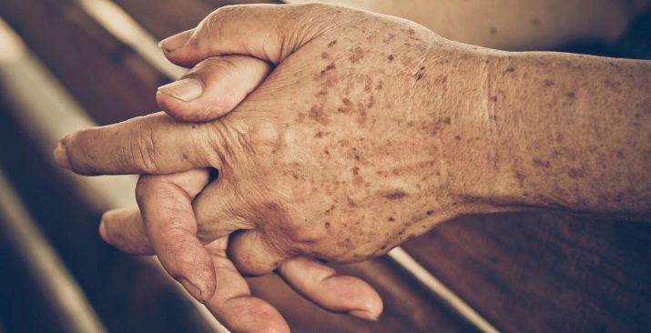 Как омолодить старую кожу рук