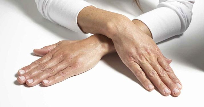 Фракционная мезотерапия кожи рук