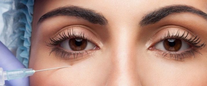 Биоревитализанты для кожи вокруг глаз