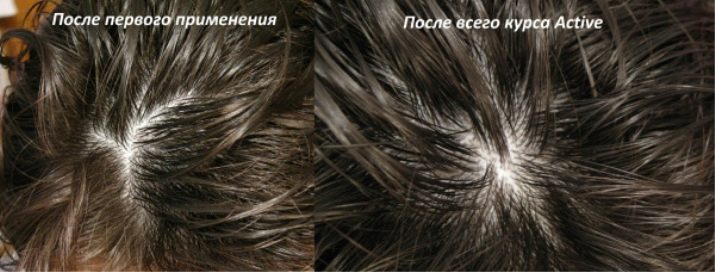 Occuba active сыворотка против выпадения волос как пользоваться