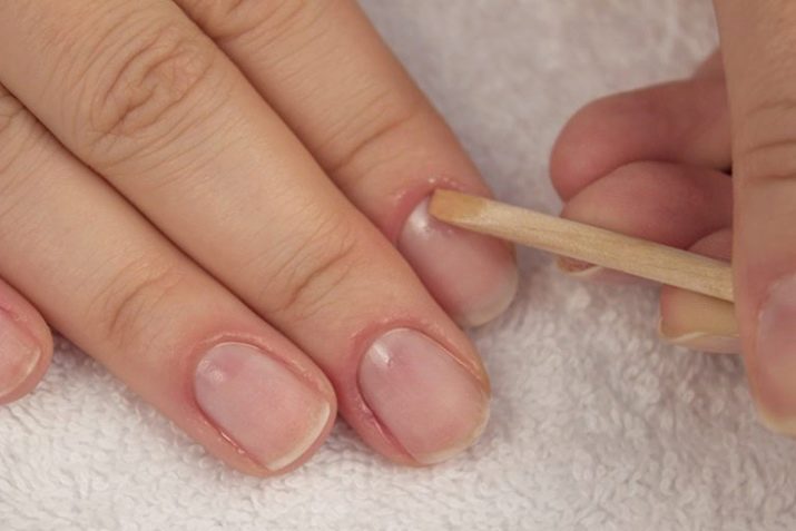 Чем стирать шеллак с кожи вокруг ногтя