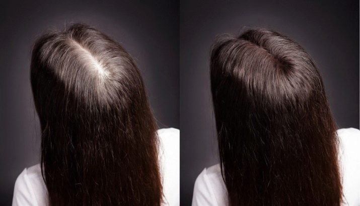 Сыворотка для роста волос Alerana: показания к применению и эффект от использования