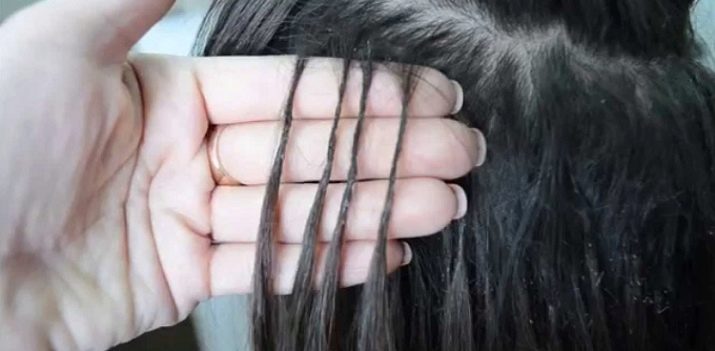 Сильное выпадение волос от наращивания