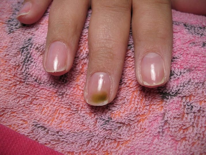 Нарощенные ногти вред или польза