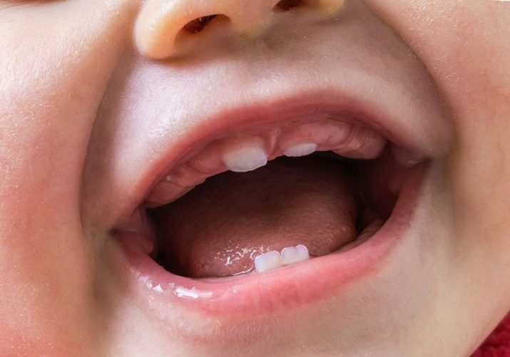 Силиконовая насадка для чистки зубов детям