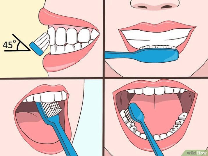 правильные движения зубной щетки при чистке зубов
