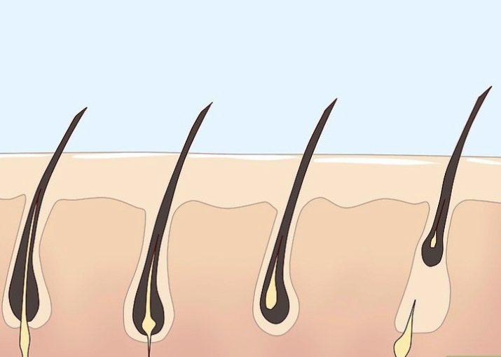 Выщипывание волос пинцетом у мужчин